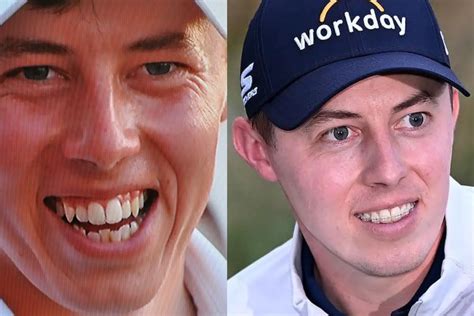 matt fitzpatrick braces|matt fitzpatrick teeth.
